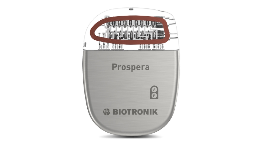 Biotronik Neuro Rolls Out AI Feature for Spinal Cord Stim